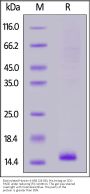 Biotinylated Human 4-1BB / TNFRSF9 (24-86) Protein, His,Avitag™