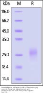 Human BMPR-1A / ALK-3 Protein, His Tag (MALS verified)