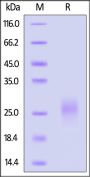 Human BMPR-1A / ALK-3 Protein, His Tag (MALS verified)