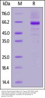 Human Glucosylceramidase Protein, His Tag