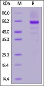 Human Glucosylceramidase Protein, His Tag