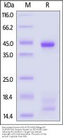 Biotinylated Human HLA-A*02:01&B2M&gp100 (YLEPGPVTA) Complex Protein (Monomer, MALS verified)