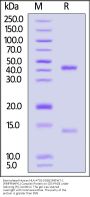 Biotinylated Human HLA-A*02:01&B2M&WT-1 (RMFPNAPYL) Complex Protein (Monomer, MALS verified)