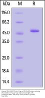 Human IDH1 (R132C) Protein, His Tag (MALS verified)