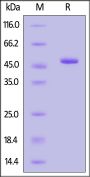 Human IDH1 (R132C) Protein, His Tag (MALS verified)