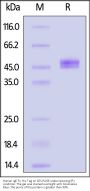 Human IgE Fc Protein, His Tag (SPR verified)