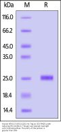 Human KRAS (2-185, G12D) Protein, His Tag (active enzyme, MALS verified)