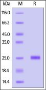 Human KRAS (2-185, G12D) Protein, His Tag (active enzyme, MALS verified)