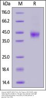 Human MASP3 (450-721) Protein, His Tag (active enzyme)