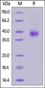 Human MASP3 (450-721) Protein, His Tag (active enzyme)