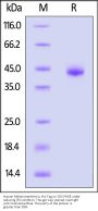 Human Melanotransferrin / CD228 Protein, His Tag (MALS verified)