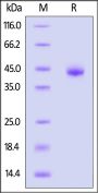 Human Melanotransferrin / CD228 Protein, His Tag (MALS verified)