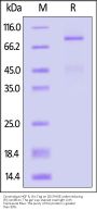 Cynomolgus HGF R / c-MET Protein, His Tag