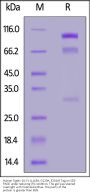 Human Siglec-10 Protein, Fc (L118A, G120A, E201A) Tag