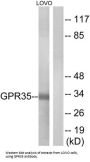 G Protein Coupled Receptor 35 (GPR35) Antibody