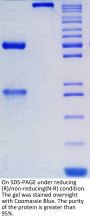 Anti-Human PD-1 [Pembrolizumab Biosimilar]