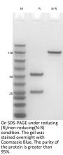 Anti-Human ANGPTL3(Evinacumab)