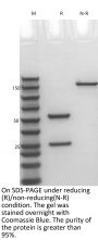 Anti-Human NGF(Fasinumab)