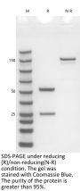 Anti-Human SOST(Romosozumab)