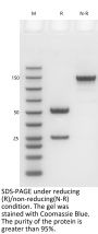 Anti-Human CD40(Sotigalimab)