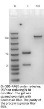 Anti-Human LOXL2 [Simtuzumab Biosimilar]