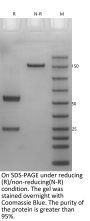 Anti-Human amyloid β(Gantenerumab)