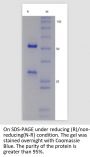 Anti-Human ADM(Enibarcimab)