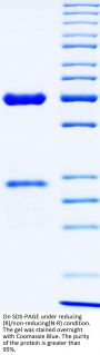 Anti-Human PD-L1(Avelumab)