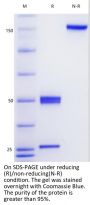 Anti-Human CD40(Sotigalimab)