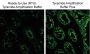 Tyramide Amplification Buffer Plus, 1000 reactions