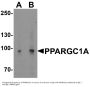 Anti-PPARGC1A Antibody