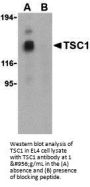 Anti-Hamartin TSC1 Antibody