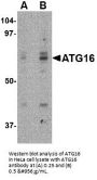 Anti-ATG16 ATG16L1 Antibody