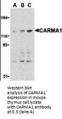 Anti-CARMA1 CARD11 Antibody