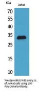 Anti-p57 CDKN1C Antibody