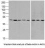 Anti-beta-Actin ACTB Antibody