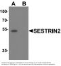 Anti-SESTRIN2 SESN2 Antibody