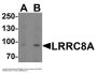 Anti-LRRC8A Antibody