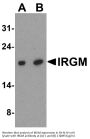 Anti-IRGM Antibody