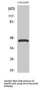 Anti-SR-4 HTR4 Antibody