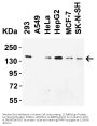 Anti-JMJD1A KDM3A Antibody