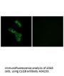 Anti-C1QB Antibody