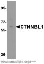 Anti-CTTNBL1 CTNNBL1 Antibody