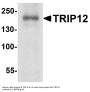 Anti-TRIP12 Antibody