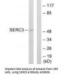 Anti-SERC3 SERINC3 Antibody