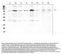 Anti-RSK3/RPS6KA2 Antibody Picoband™