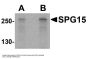 Anti-SPG15 ZFYVE26 Antibody