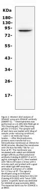 Anti-Semaphorin 3E/SEMA3E Antibody Picoband™