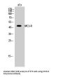 Anti-MC5-R Antibody