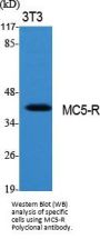Anti-MC5-R Antibody